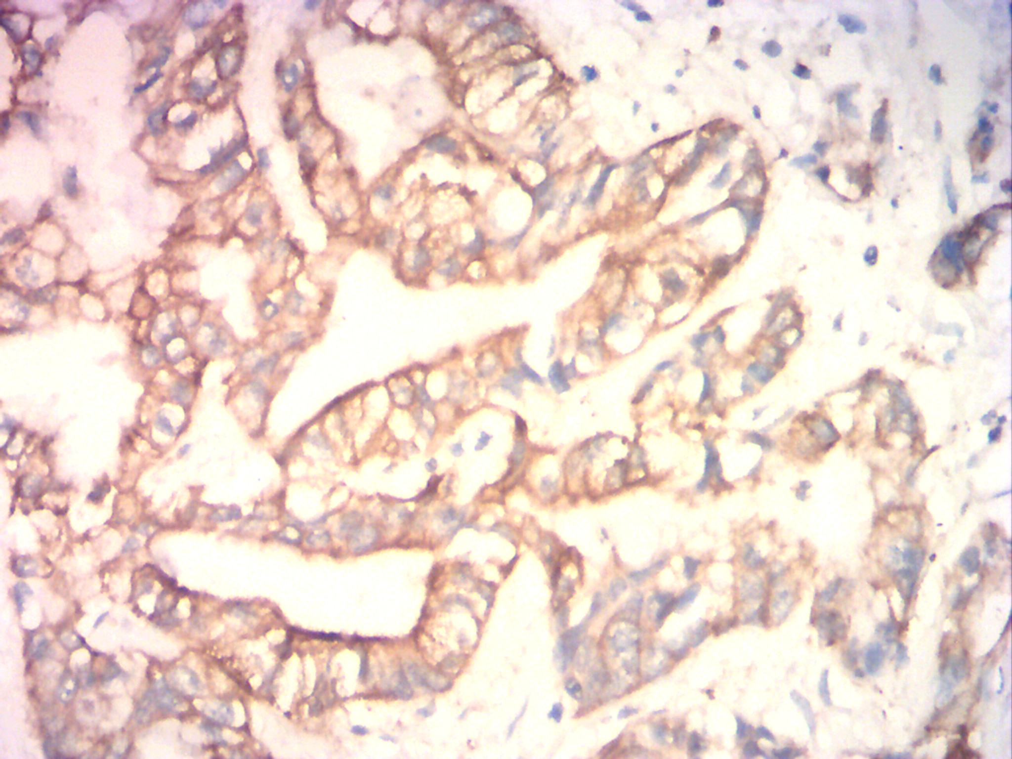 IHC
